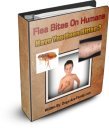 Flea Bite Pictures